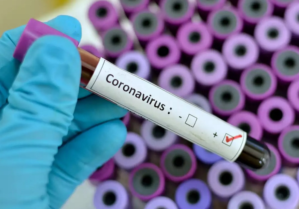 यूपी में शनिवार को पिछले 24 घंटों में 30317 नए कोरोनावायरस पाजिटिव, मौत की संख्या सुन चौंक जाएंगे