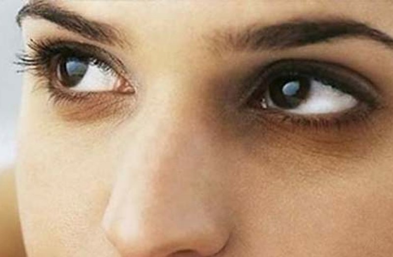 आंखों के नीचे छा गए हैं काले घेरे, घर में करें यह उपाय, दूर होगी समस्या