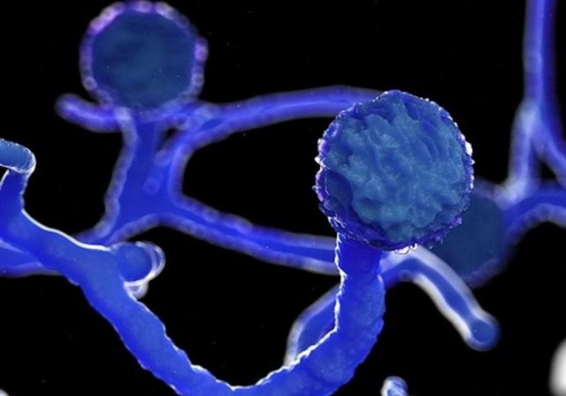 कोरोना के बाद ब्लैक फंगस के बढ़ रहे मामले, बीएचयू में आए पांच से ज्यादा मामले, आंखों पर पड़ रहा असर