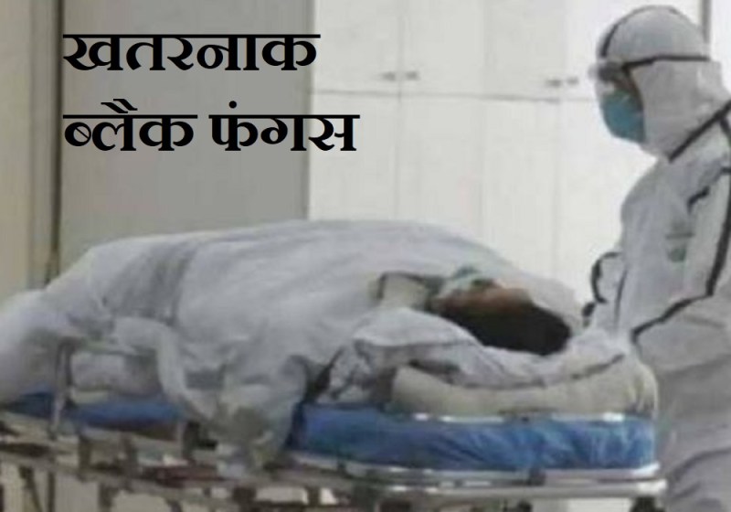 UP Top News: खतरनाक ब्लैक फंगस से लखनऊ में एक मौत