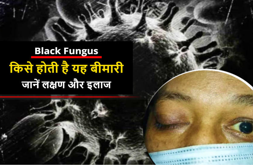 black_fungus_symptoms_in_hindi.jpg