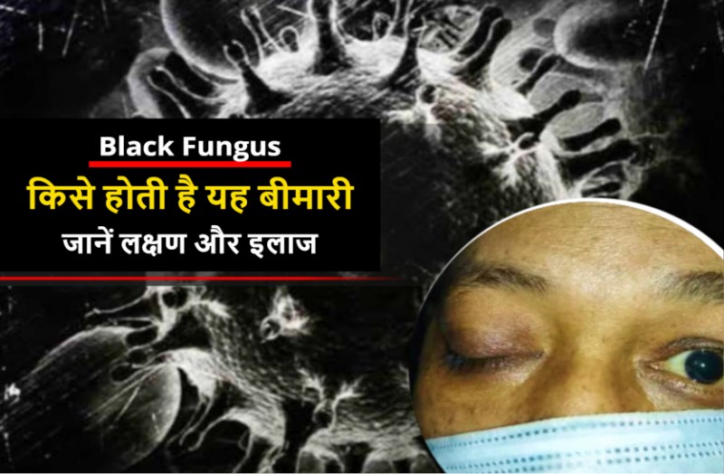black_fungus_symptoms_in_hindi.jpg