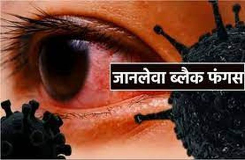 कोरोना से जंग जीतकर ज्यादा खुश मत होइए,अब ब्लैक फंगस के बढ़ रहे मरीज,नेत्र ज्योति गंवाने का बढ़ा खतरा