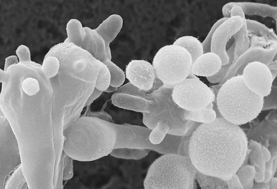 White Fungus four cases confirmed in Patna