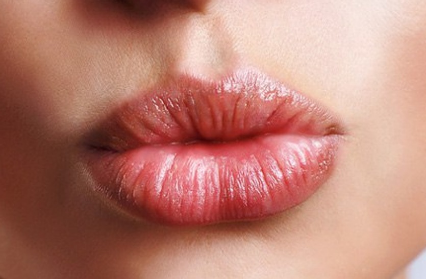 pink lips Home remedies