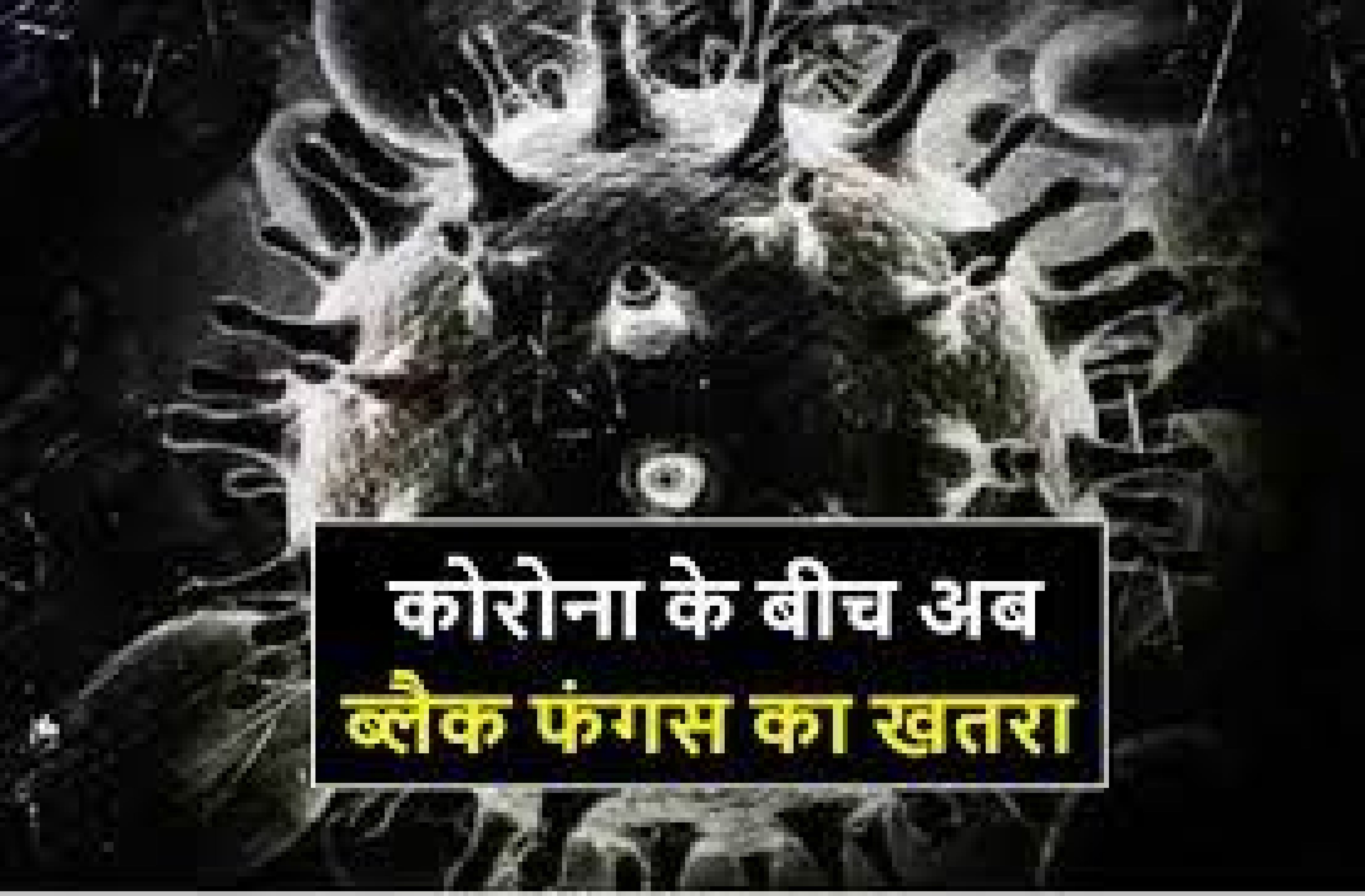 4 नए ब्लैक फंगस के मरीज मिले, 5 मरीजों का हुआ ऑपरेशन