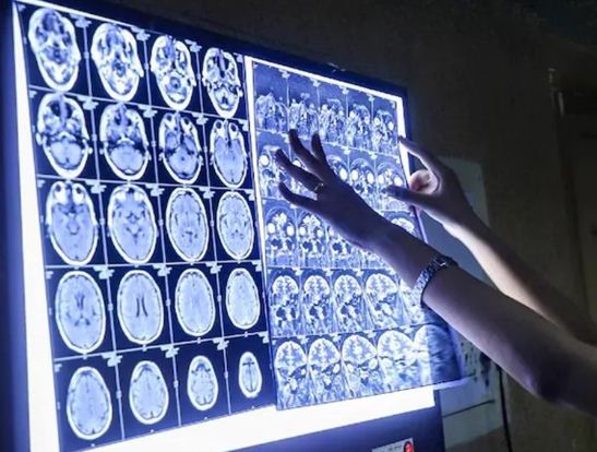 Black Fungus Can not survive in freeze and Onion says Extperts