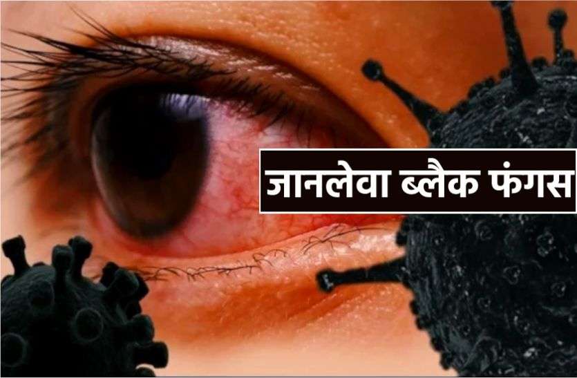 कोरोना संक्रमण के बीच फंगस का ‘काला’ साया