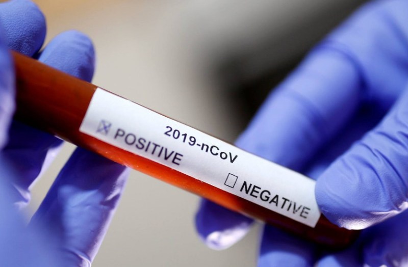 Rajasthan coronavirus cases latest update today 16 june 2021