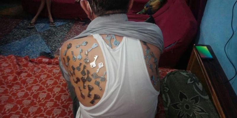 कोरोना वैक्सीन के बाद व्यक्ति के शरीर पर चिपक रहे बर्तन और चाबी, डॉक्टर बता रहे अफवाह