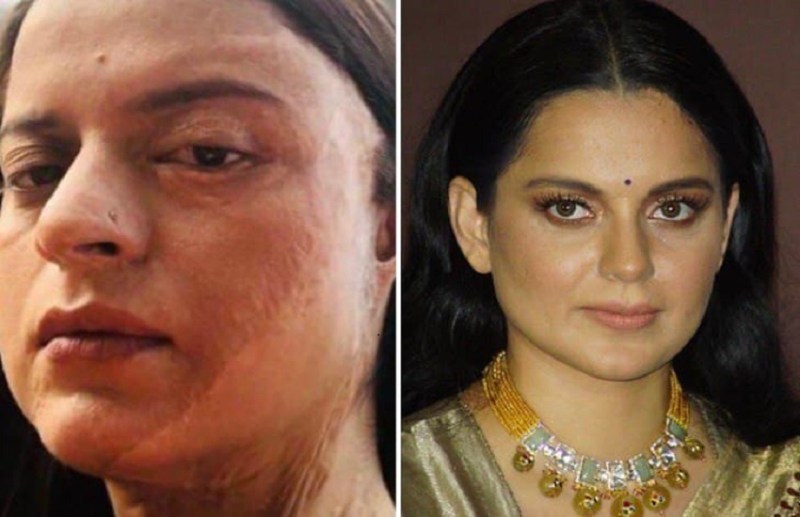 Kangana Ranaut Shares Rangoli Acid Attack Story