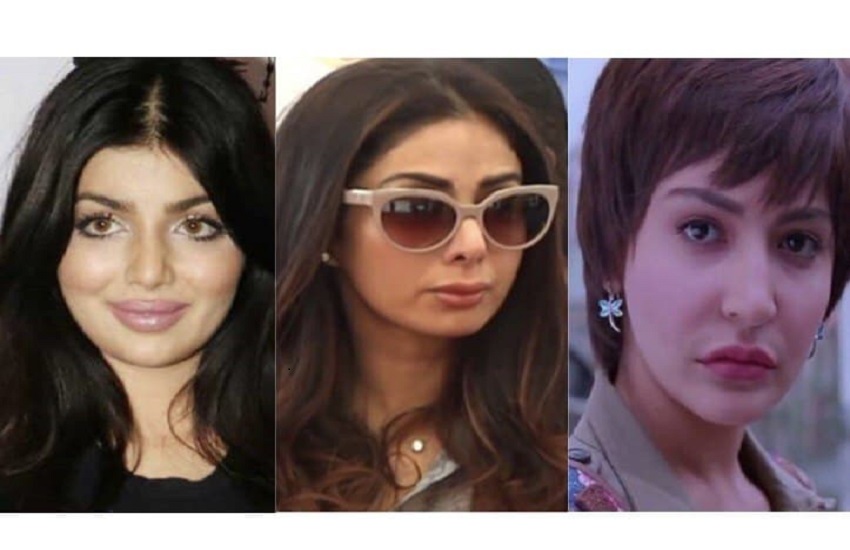 Bollywood Actress Who Have Allegedly Undergone Plastic Surgery