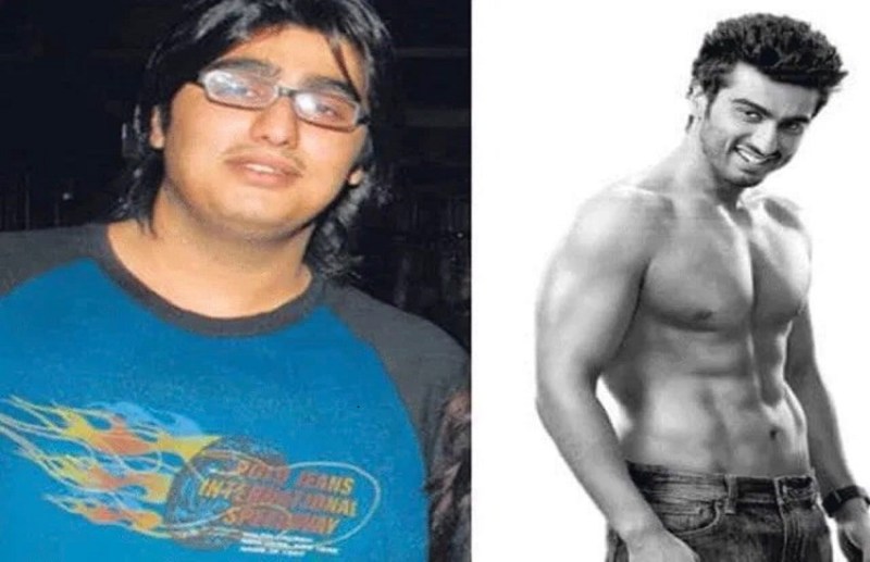 Arjun Kapoor Loose 50 Kg Weight Without Surgery