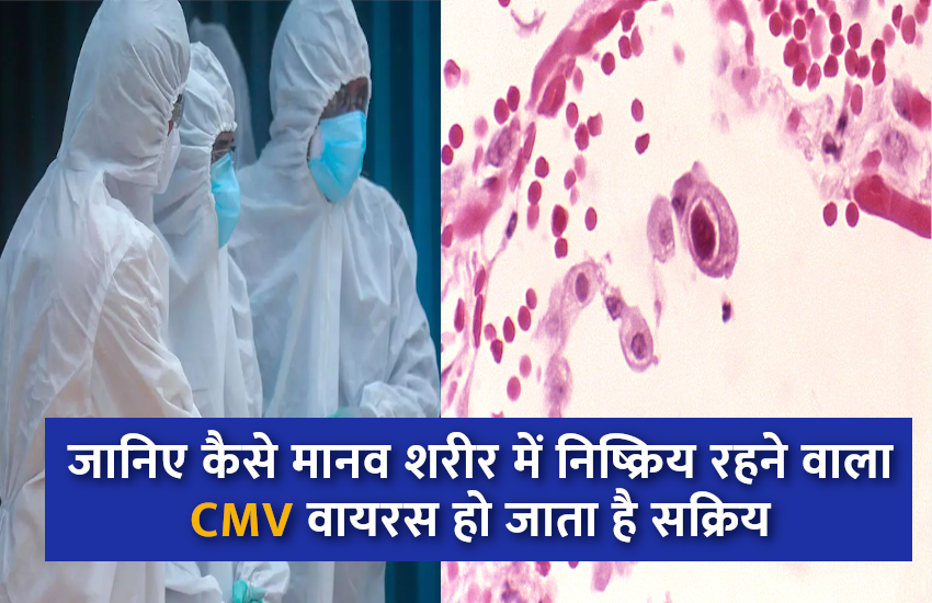 Cytomegalovirus Infection