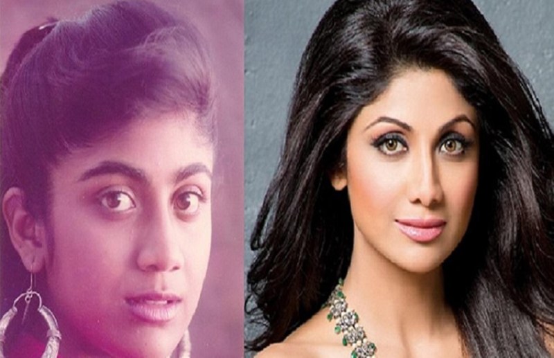 Bollywood These Actresses Who Got Nose Cosmetic Surgery