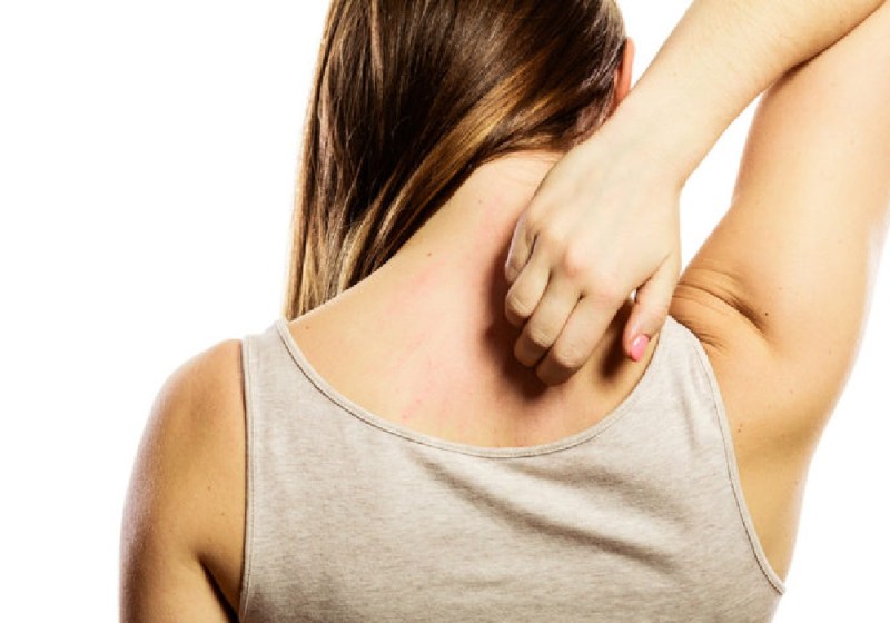 बदलते मौसम में स्किन और फंगल इंफेक्शन के प्रति रहें सतर्क, ऐसे करें बचाव