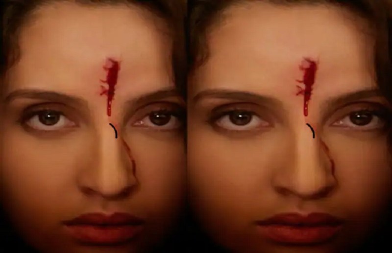 Nora fatehi blood coming out of the forehead