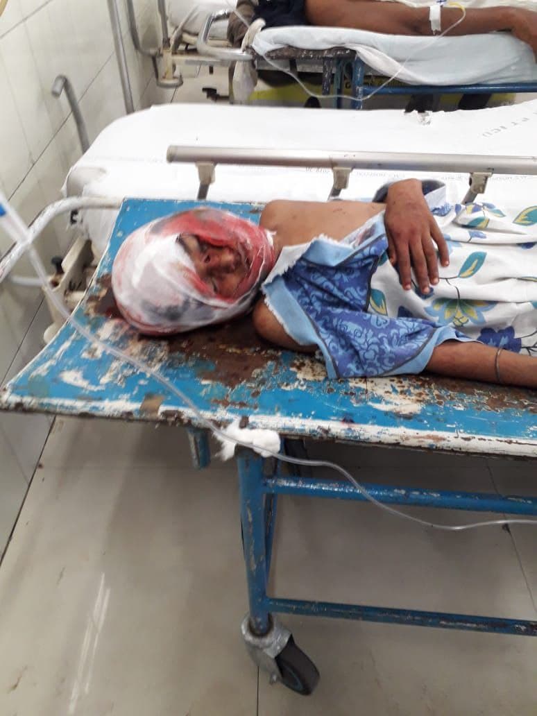 पालतू कुत्ते ने बच्चे पर किया हमला, इतना नोंचा की बच्चा हो गया अधमरा