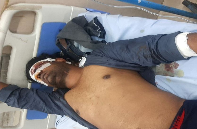 कोटा के एमबीएस अस्पताल में भर्ती घायल युवक 