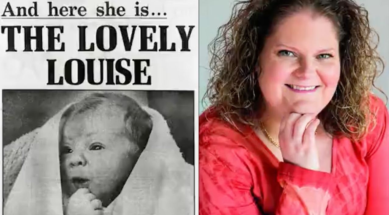 25 जुलाई: वर्ल्ड एम्ब्रायोलॉजिस्ट डे- दुनिया की पहली टेस्ट ट्यूब बेबी हैं लुइस