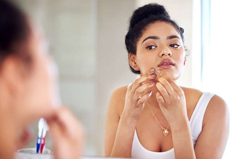 Continue struggling with pimples these daily habits may be the reason