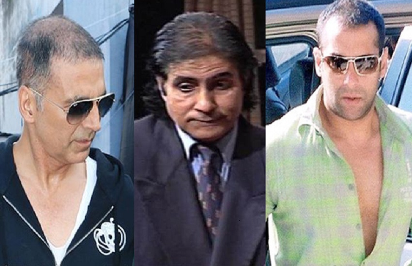 These Bollywood stars who went bald and got hair transplant surgery