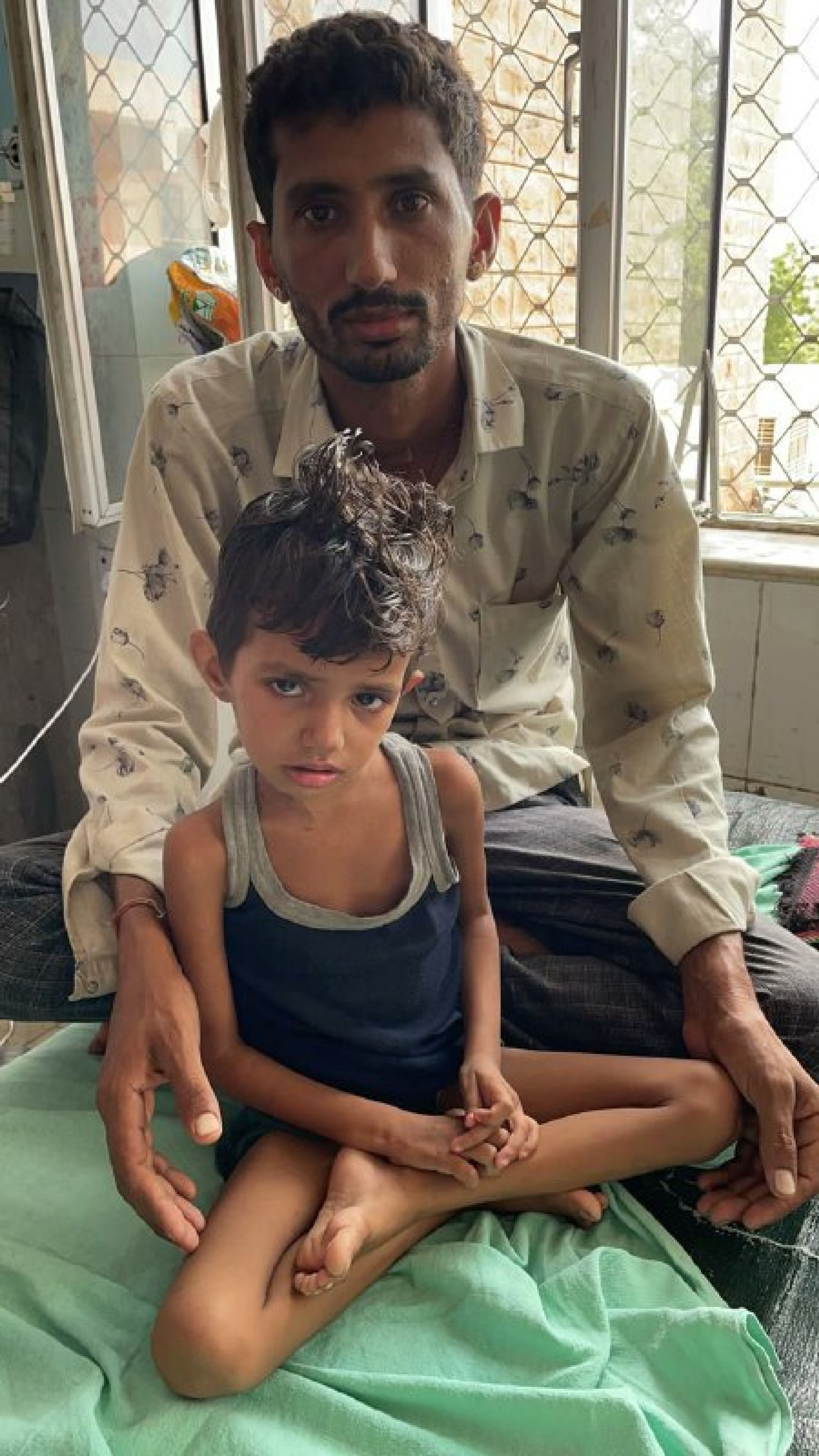 डायफ्रॉम हर्निया का जोधपुर में अनूठा मामला, एमडीएम में सफल सर्जरी