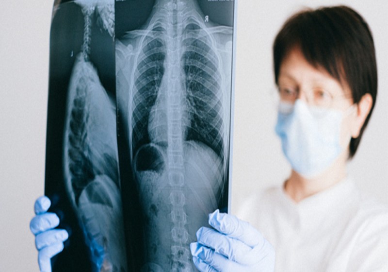 passive cases of TB hidden