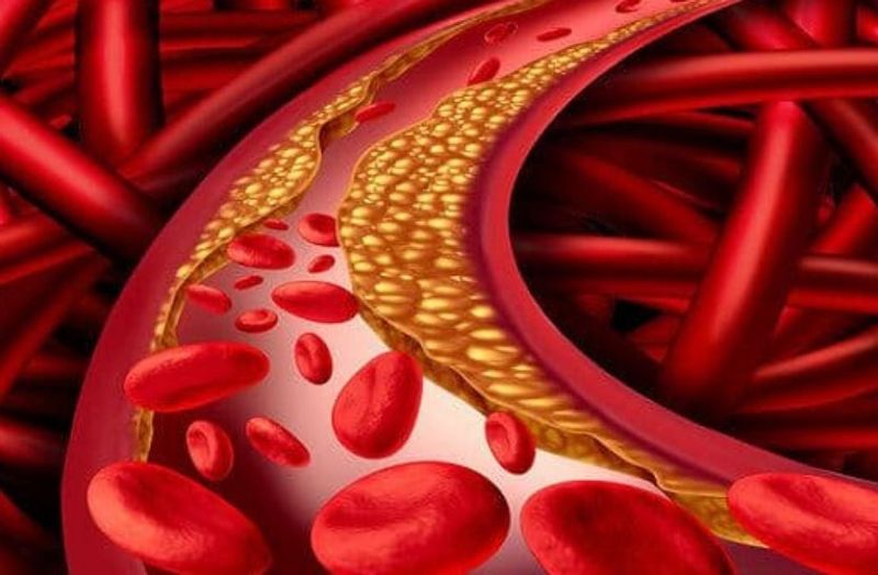 Cholesterol control : शरीर में इस कारण बढ़ता है कोलेस्ट्रॉल, कंट्रोल करने के लिए करें यह उपाय