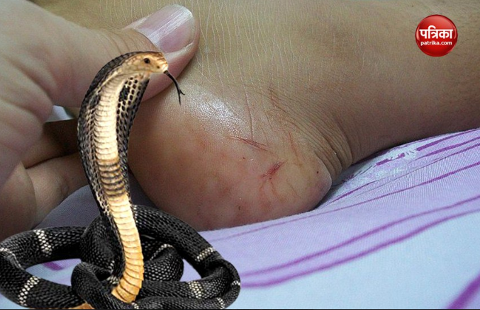 Snake Bite Treatment