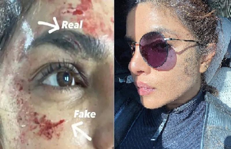 Priyanka Chopra injured