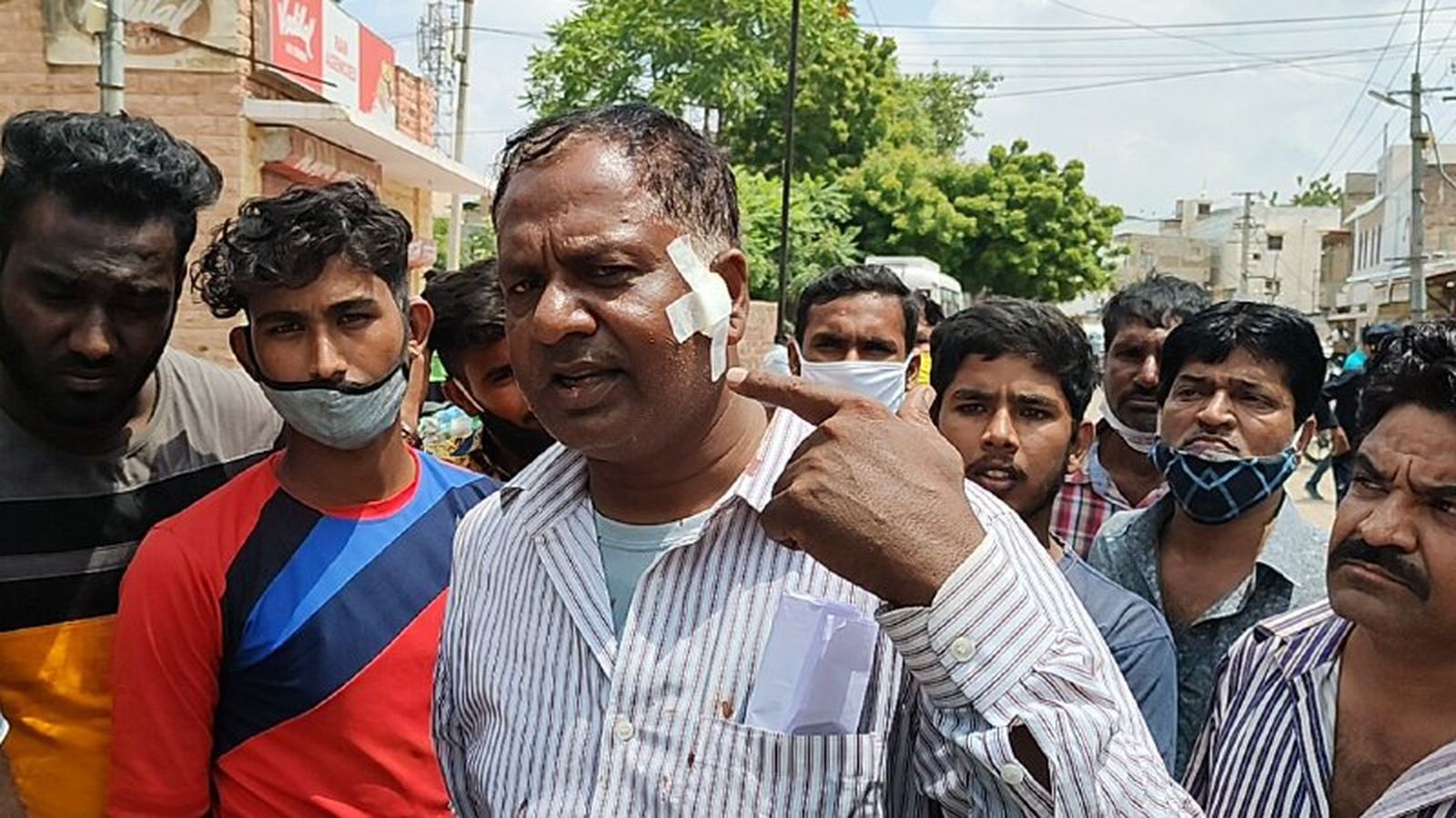 नाले से अतिक्रमण हटाने पर विवाद, पार्षद घायल