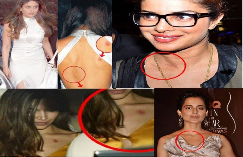 Bollywood actress caught with love bites