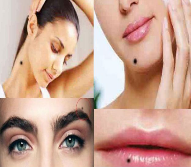 Astro Tips: Know about Love or Arranged Marriage from your Moles
