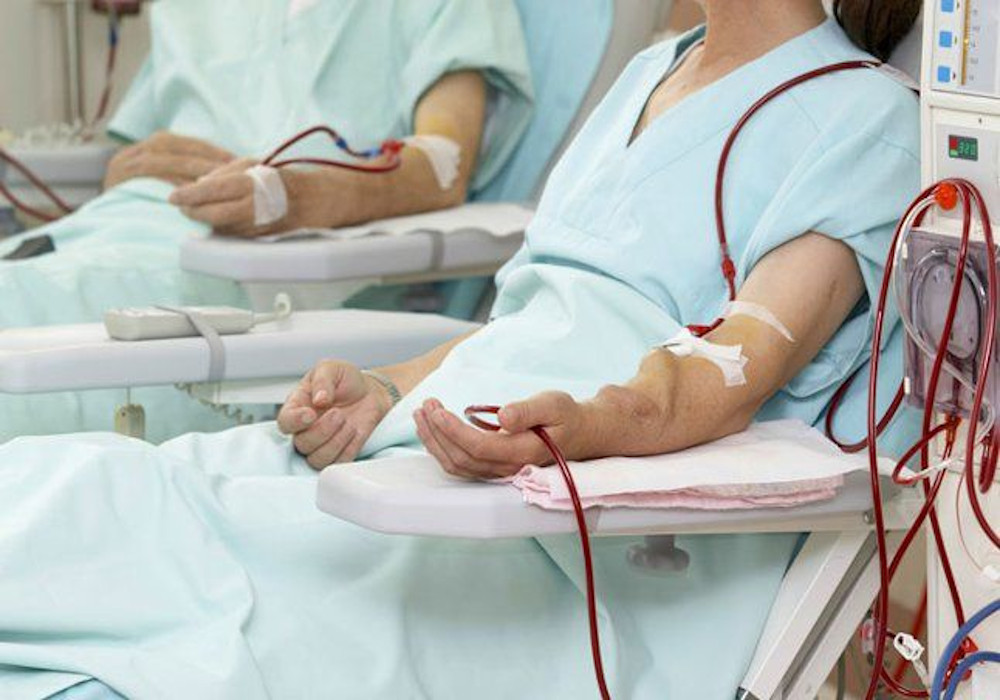 Preparations to Set up Dialysis Units in 20 Districts in UP