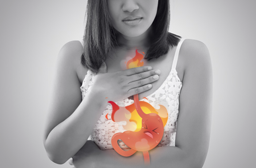 How To Get Rid Of Acidity