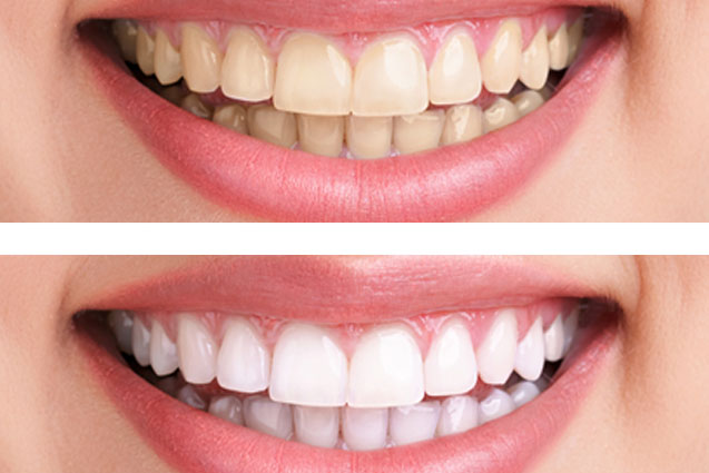 teeth.jpg