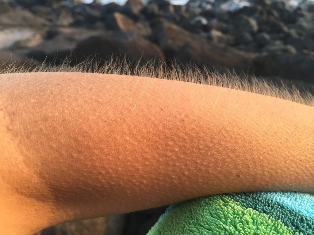 goosebump.jpg