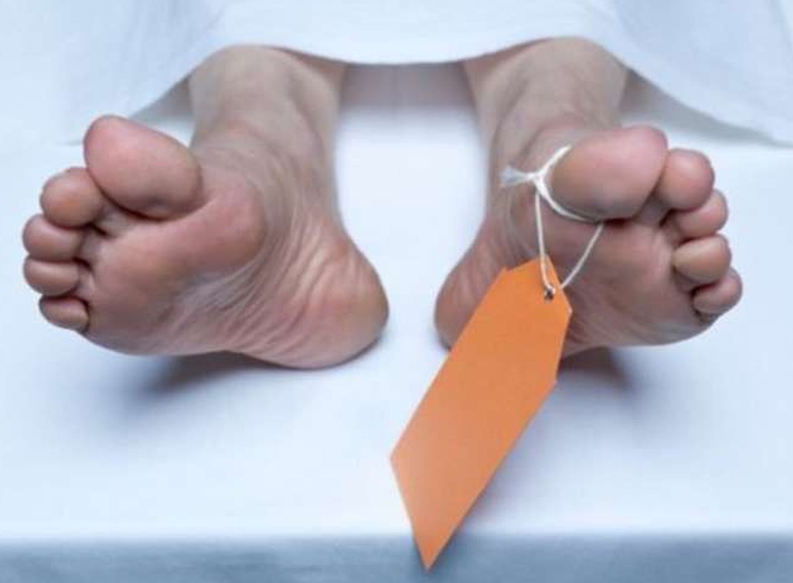 कोरोनकाल: देहदान में जागृति, पिछड़ गया नेत्रदान