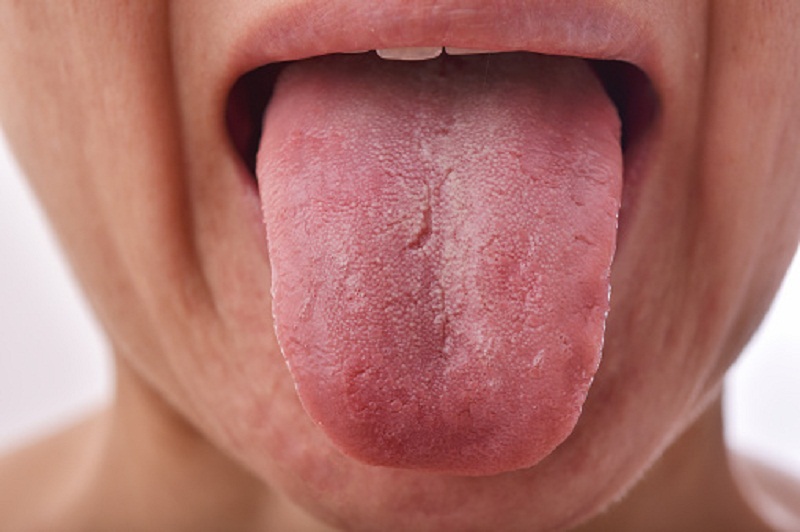 tongue.jpg