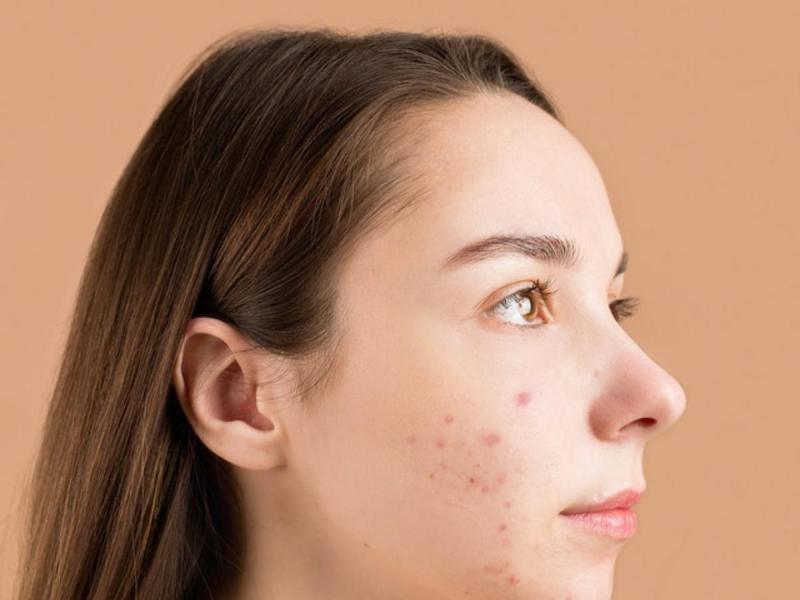 त्वचा में एलेर्जी से पाना चाहते हैं छुटकारा तो अपना सकते हैं इन उपायों को , दाद-खुजली से जल्द मिलेगी आराम