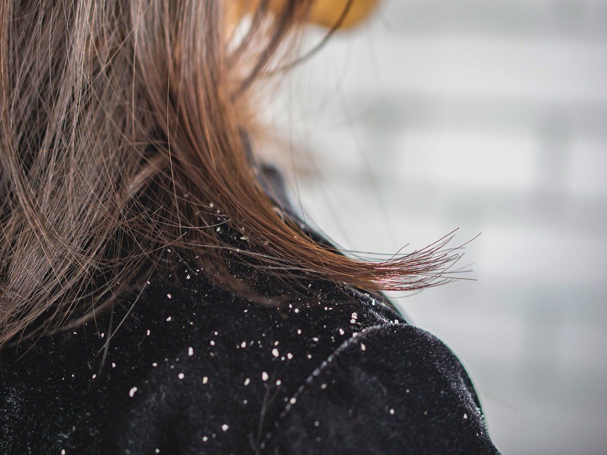 Hair care : ठंड में ऐसे करें बालो की एक्स्ट्रा केयर