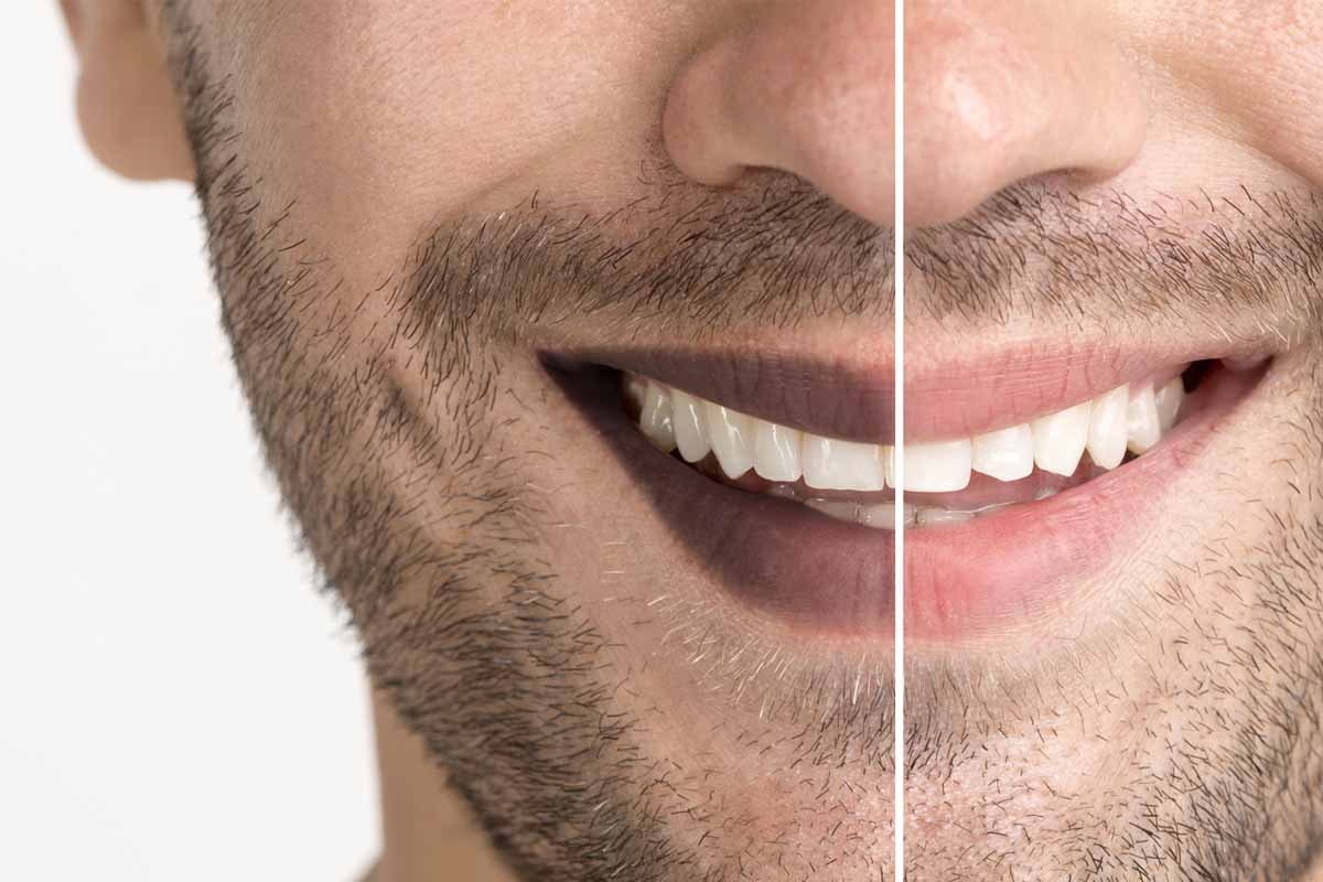 How to lighten dark lips: होठों से कालापन को करना चाहते हैं दूर तो अपना सकते हैं इन आसान से घरेलू उपायों को