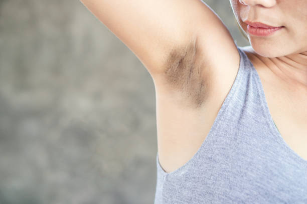 Home Remedies for Dark Underarms: अपने अंडरआर्म्स के कालेपन को दूर करने के लिए करें ये घरेलू उपाय