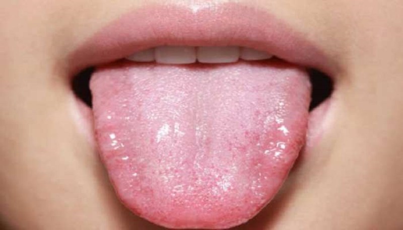 Vitamin D Deficiency: आपकी जीभ भी देती है विटामिन डी की कमी के संकेत,इन लक्षणों को न करें इग्नोर