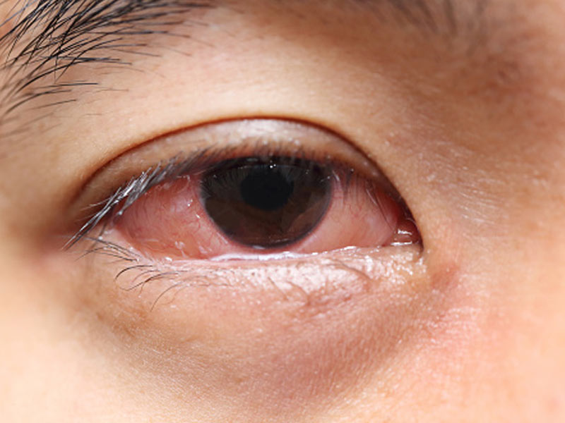 easy way to take care of eyes