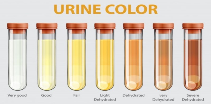 urine_color.jpg