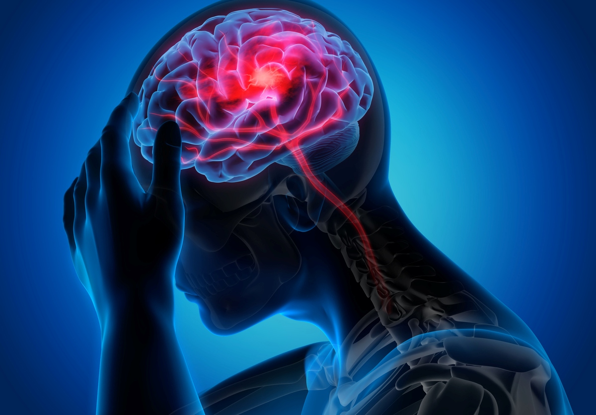 brain_stroke.jpg