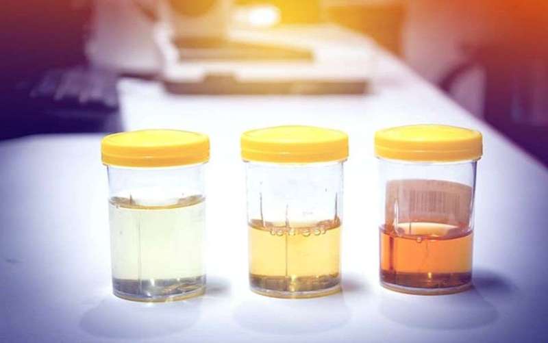 health depends on urine-colour