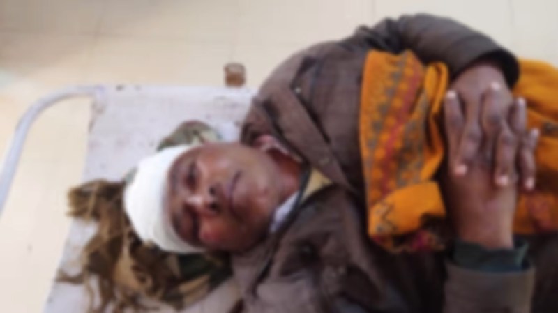 UP Assembly Elections 2022 : मतदान के दौरान पीठासीन अधिकारी और सिपाही पर हमला,एसएसपी मौके पर